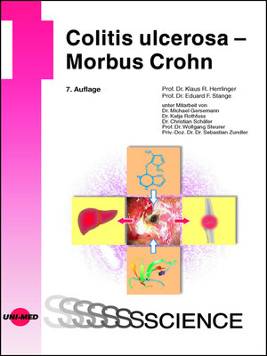 cover image of Colitis ulcerosa – Morbus Crohn